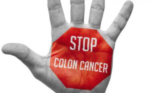 Colon Cancer Treatment Options